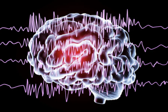 An image of brain waves emblematic of generalized epilepsy.